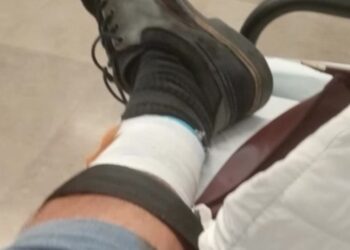 “Bateram na minha mota por trás”: acidente na Pedrulha faz três feridos