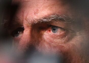 Advogados de Bolsonaro pedem liberação para exames por conta de crises de soluço