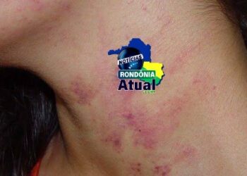 Discussão entre casal termina em agressões e ameaças em Ji-Paraná