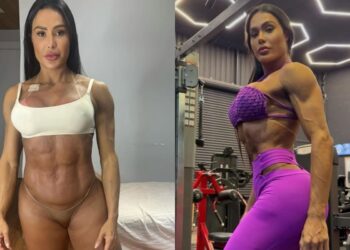 Gracyanne explica ganho de 20 kg após cirurgia: “Tomei um susto”