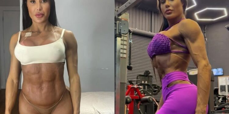 Gracyanne explica ganho de 20 kg após cirurgia: “Tomei um susto”