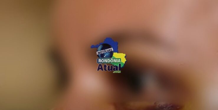 Briga no forró: Mulheres dão entrada no Hospital Municipal em Ji-Paraná com o rosto arrebentado de porrada