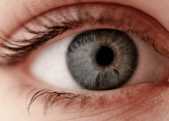 Ceratocone: Especialistas alertam para riscos de coçar os olhos