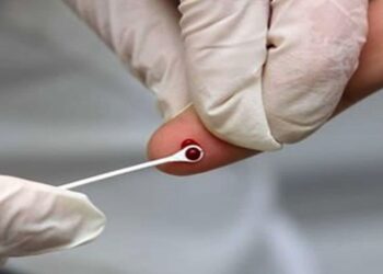 sp-reduz-em-17%-o-numero-de-mortes-por-aids-e-segue-tendencia-nacional-de-queda