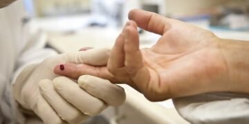 Brasil aprova nova injeção semestral para prevenção do HIV