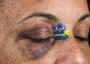 Ji-Paraná-Homem surta de ciúmes, quase quebra a cabeça da mulher, jogando contra a parede e foge