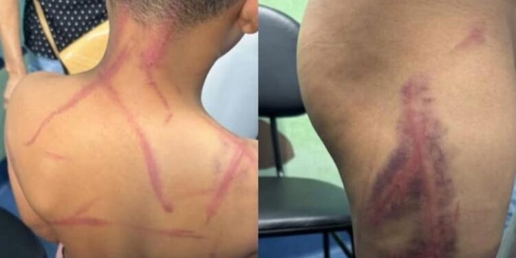 Pastores são presos por suspeita de tortura contra criança de 9 anos