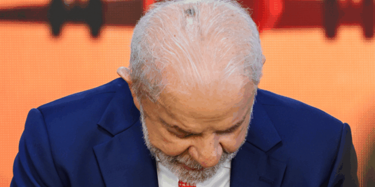 Lesão no couro cabeludo de Lula era um câncer basocelular